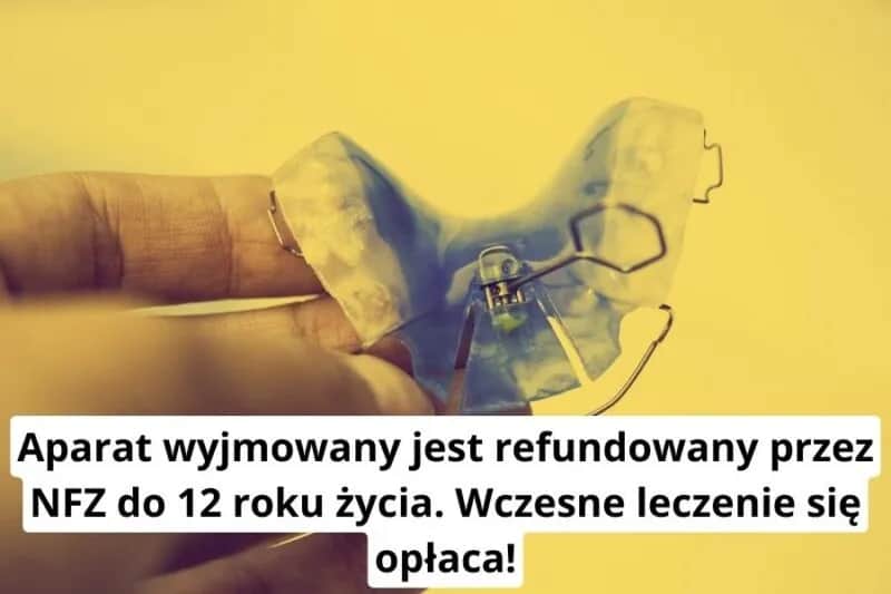 Ile naprawdę kosztuje aparat ruchomy? Sprawdź, czy Cię na to stać!