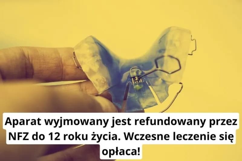 Ile naprawdę kosztuje aparat ruchomy? Sprawdź, czy Cię na to stać!